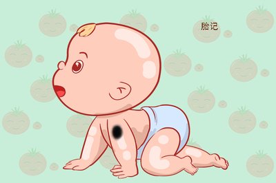 胎记15