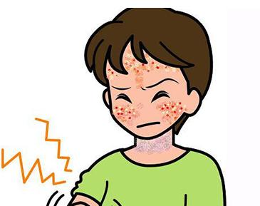 过敏性皮炎治疗方法有哪些【厦门广肤皮肤病医院正不正规】